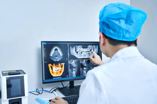 Best Emergency Dentist for Lost Fillings or Crowns in Iowa City, IA