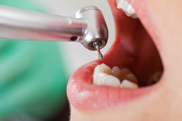 Best Orthodontic Emergency Dentist in Iowa City, IA